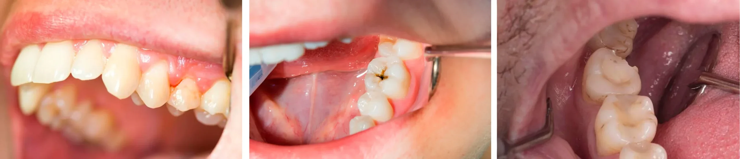 Exemplos Rasteli 2 copiar